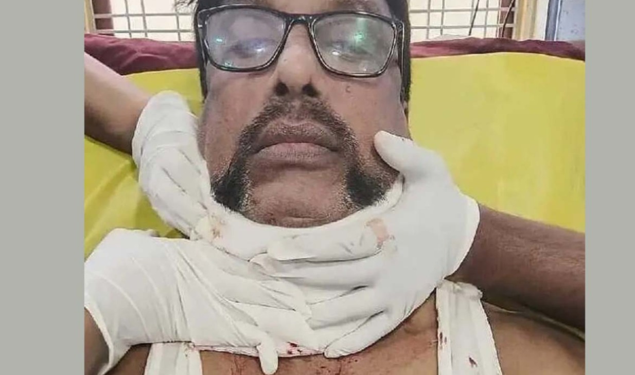 حیدرآباد: مانجے کی زد میں آکر اے ایس آئی شدید زخمی