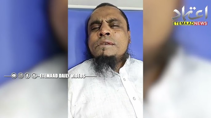مولانا غیاث احمد رشادی اور ڈرائیور زخمی، آندھرا پردیش میں کار حادثہ
