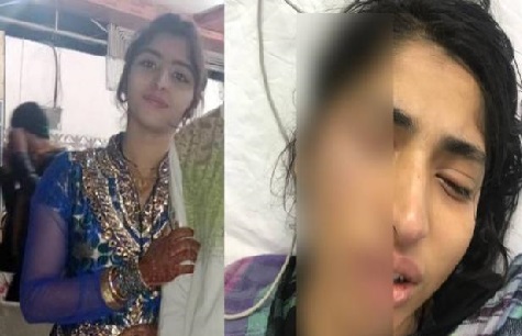 حیدرآباد: دیر رات وائی-فائی بند کرنے پر شوہر نے بیوی کی پٹائی کردی