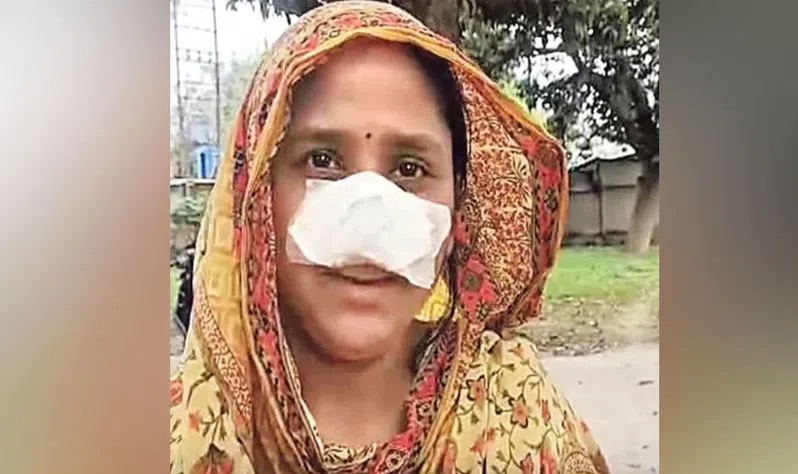 شوہر نے بیوی کی ناک کاٹ ڈالی