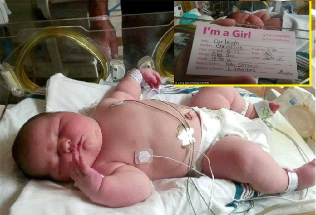 دنیا کی سب سے وزنی بچی کی امریکہ میں پیدائش