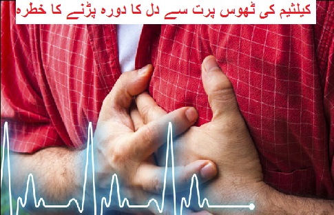 کیلثیم کی ٹھوس پرت سے دل کا دورہ پڑنے کا خطرہ زیادہ