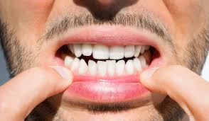  دانتوں اور منہ کی صحت کے بارے میں جاننے کی ضرورت ہے۔