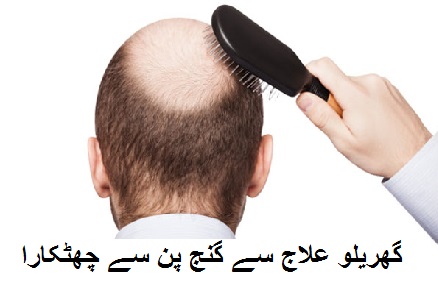 گھریلو علاج سے گنج پن سے چھٹکارا 