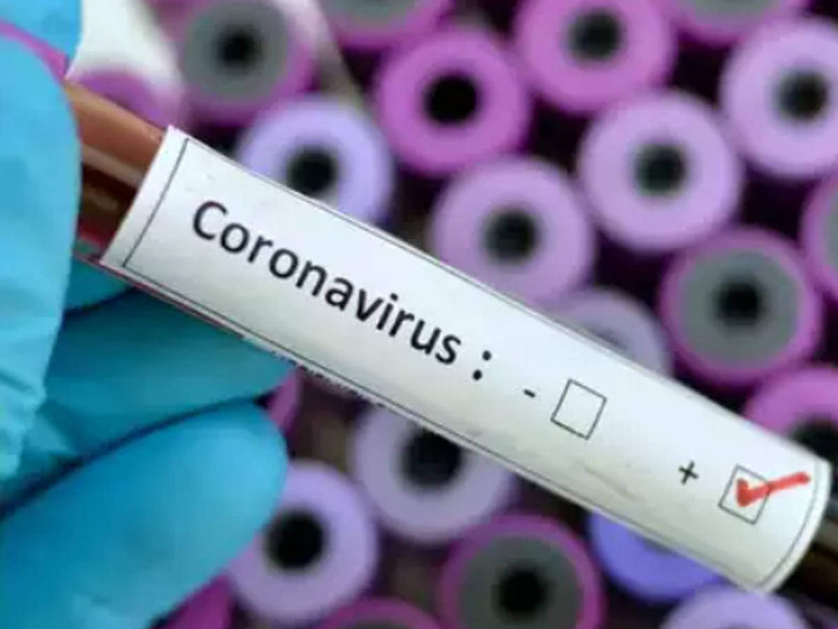 ملک میں کورونا وائرس کے تقریباََ دو ہزار نئے کیسز، ہلاک شدگان کی تعداد 1147 پہنچی
