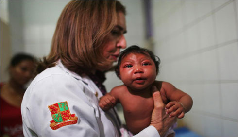  زیکا وائرس:برازیل ، اسقاط حمل قوانین میں نرمی کرے،یو این
