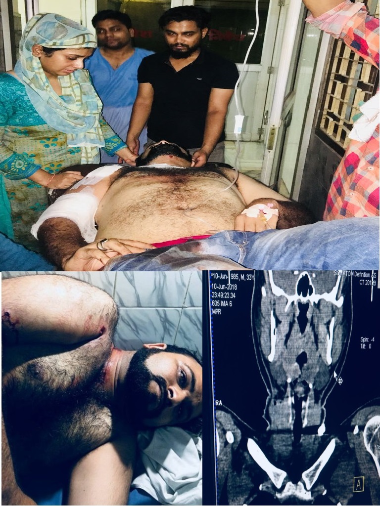 ڈاکٹر کفیل خان کے بھائی کو موٹر سیکل سوار نے ماری گولی