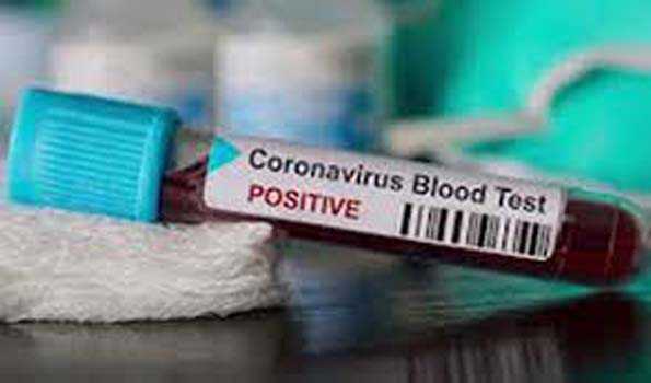 یو اے ای میں کورونا وائرس کے 994 نئے کیسز